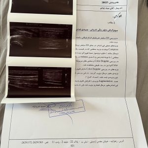 لاستیک سایز ۸۰۰۸